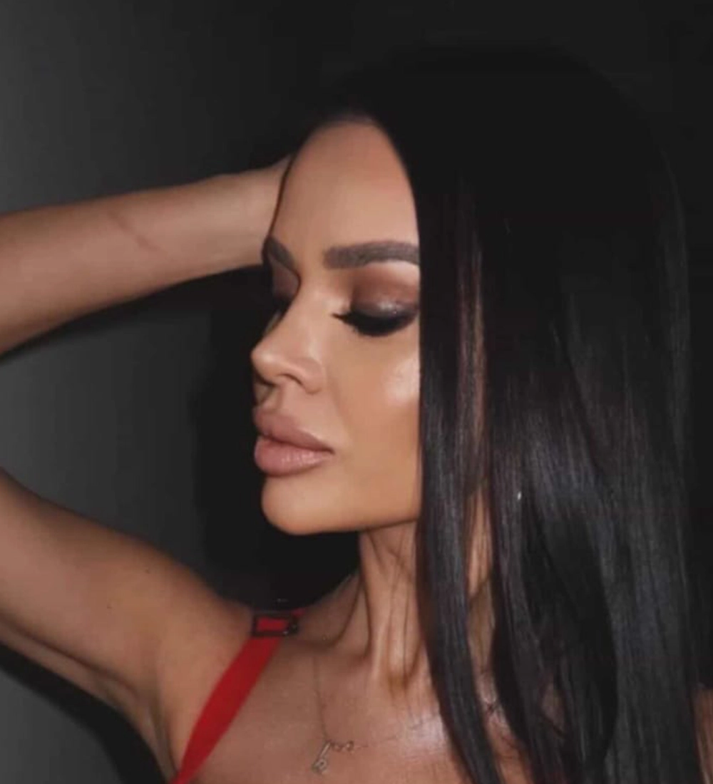 Long-term rhinoplasty result — Op. Dr. G. Arda Pelen