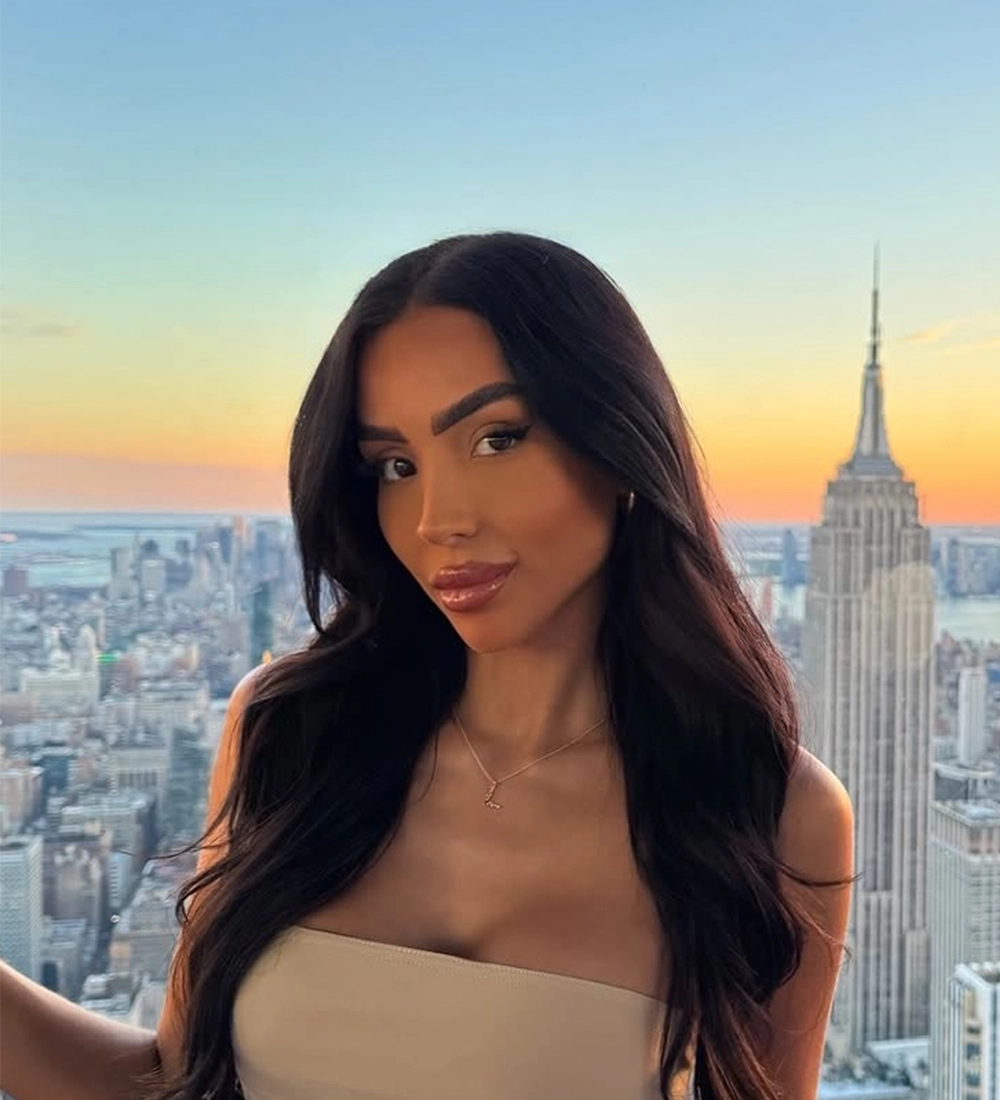 Long-term rhinoplasty result — Op. Dr. G. Arda Pelen