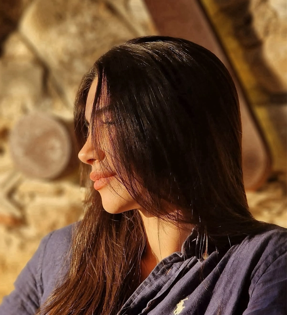 Long-term rhinoplasty result — Op. Dr. G. Arda Pelen
