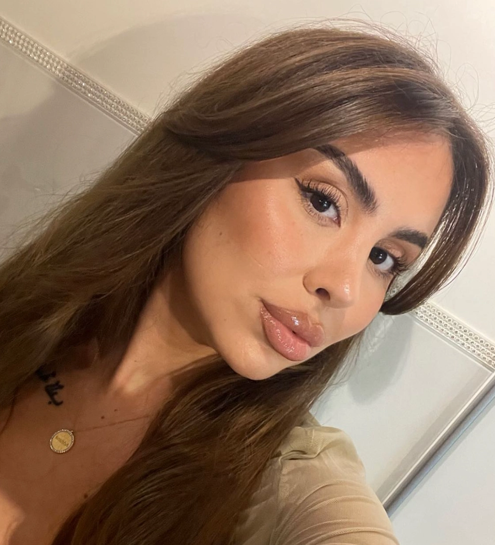 Long-term rhinoplasty result — Op. Dr. G. Arda Pelen
