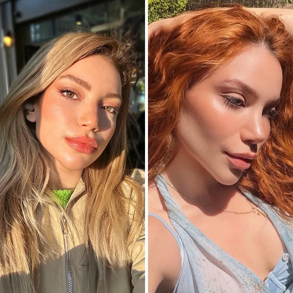 Rhinoplasty before and after — Op. Dr. G. Arda Pelen